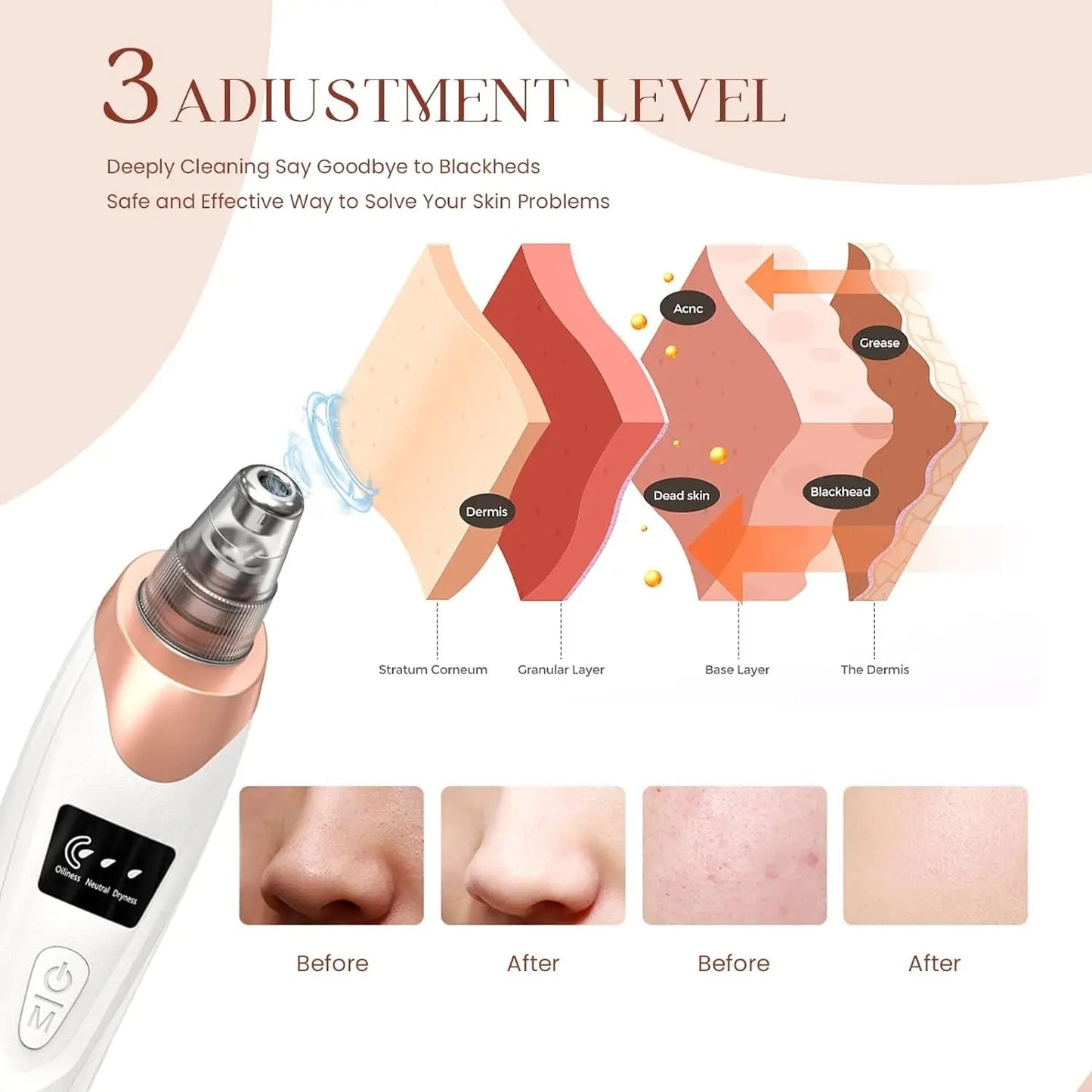 5-in-1 SkinGlow Blackhead Remover Kit & Multi-Function Skin Cleansing Tools.